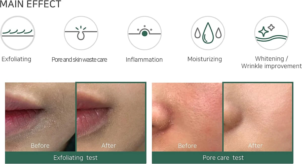 سام باي مي – تونر مقشّر AHA-BHA-PHA معجزة 30 يوم | Some By Mi Miracle Toner